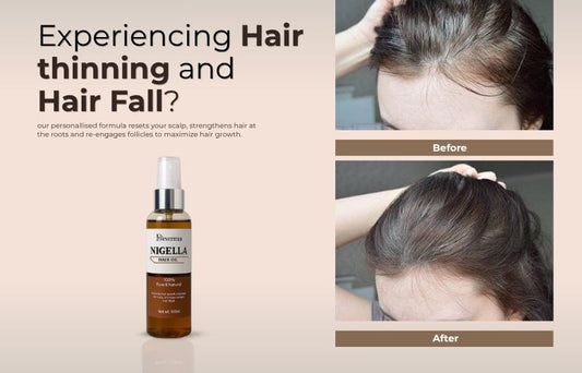 reasons for hair fall